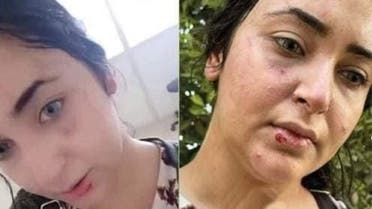 الصيدلانية التي تعرضت للسحل