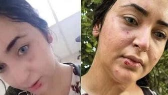 إخلاء سبيل صيدلانية مصرية زعمت تعرضها للضرب لعدم ارتداء الحجاب