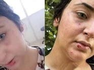 إخلاء سبيل صيدلانية مصرية زعمت تعرضها للضرب بسبب عدم ارتداء الحجاب