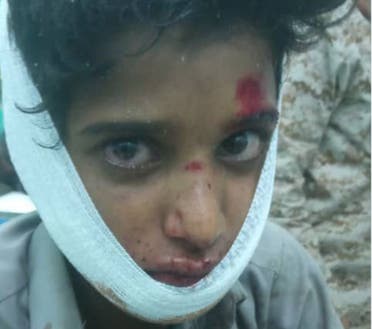 طفل من ضحايا الحوثيين في مأرب