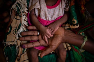 Abeba Gebru, 37, from the village of Getskimilesley, holds the hands of her malnourished daughter, Tigsti Mahderekal, 20 days old, in the treatment tent of a medical clinic in the town of Abi Adi, in the Tigray region of northern Ethiopia, on Tuesday, May 11, 2021. (AP)