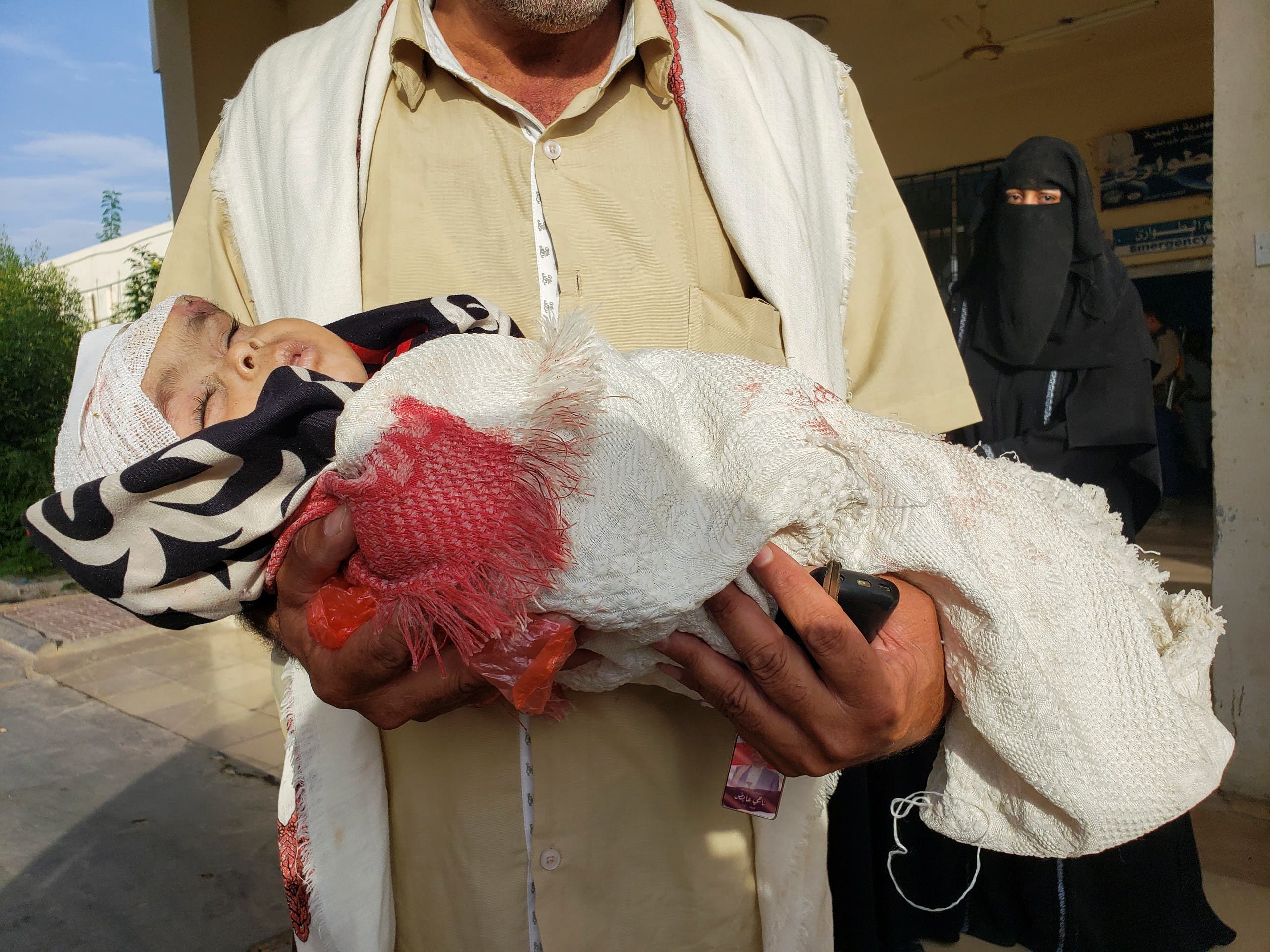 طفلة أصيبت في قصف حوثي على منزل في مأرب (أرشيفية)