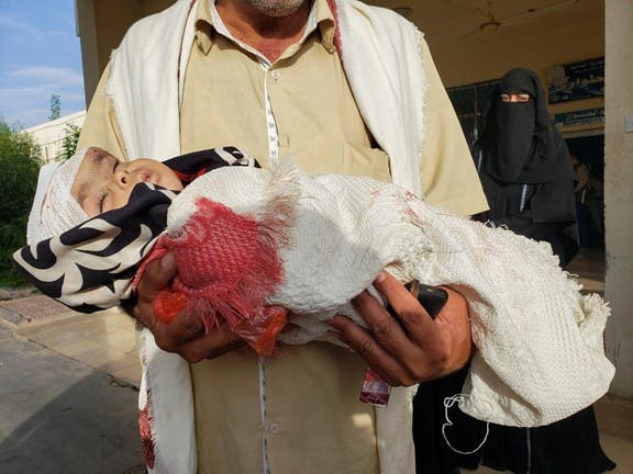کودکی که توسط شبه‌نظامیان حوثی کشته شد