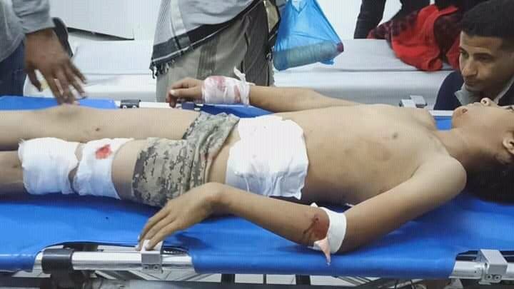 تعز 28 نوفمبر 2021 إصابة الطفل الطفل محمد صادق أحمد  في قصف حوثي على حي سكني