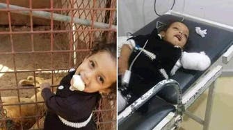 صور مؤلمة.. أسد يلتهم يد طفلة يمنية 