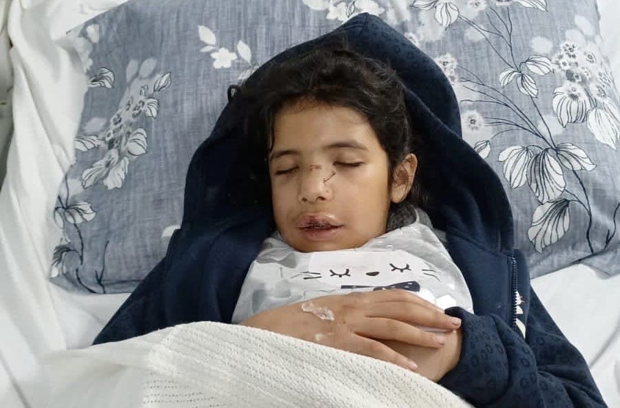 One of the injured children from the other side
