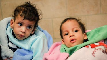 A handout picture released on December 2, 2021 by the United Nations children’s agency UNICEF shows conjoined twins Mohamed and Ahmed shortly after arriving at the Yemeni capital Sanaa. (AFP)