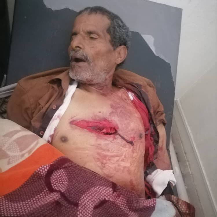 حادثة مؤلمة.. ميليشيا الحوثي تقتل مسناً أمام عائلته