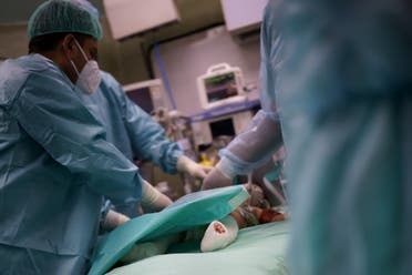 An MSF-supported surgical team at Al-Shifa’s burn unit, in Gaza city changes patient’s dressing under anesthesia. Al-Shifa’s burn unit is the main referral unit for all hospitals in Gaza where on average 270 patients are treated annually.. (Supplied)