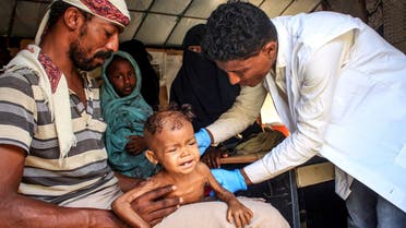 Three-year-old Yemeni child Randa Ali, suffering from severe acute malnutrition, is carried by her father as she is checked by a doctor at a clinic in Al-Khudash camp for displaced people in the Abs district of Yemen's northwestern Hajjah governorate, on February 19, 2022. (AFP)