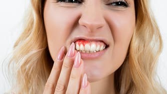 إياك إهمال صحة الفم.. دراسة تكشف مفاجأة مدوية!