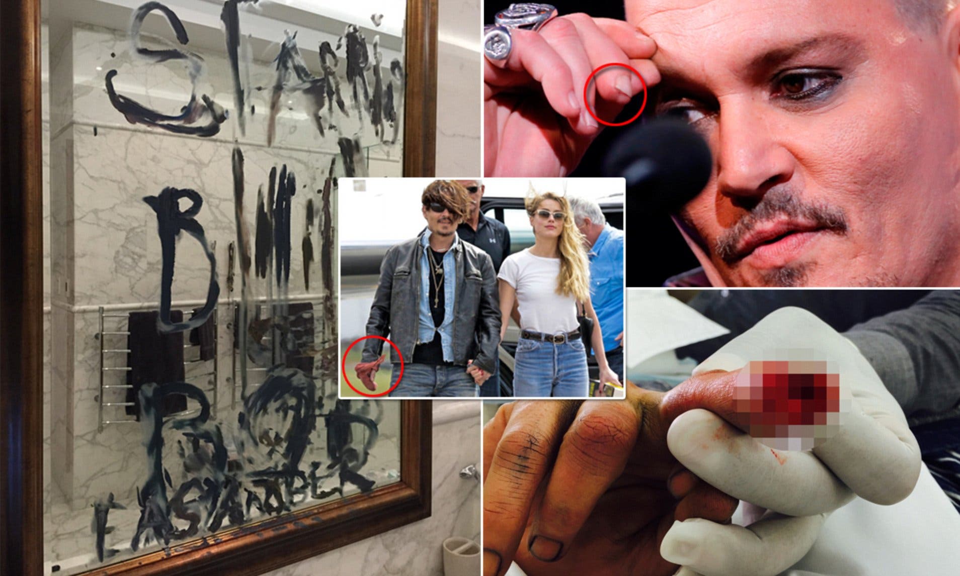 صور تظهر القطع في إصبع جوني ديب - نقلا عن ديلي ميل