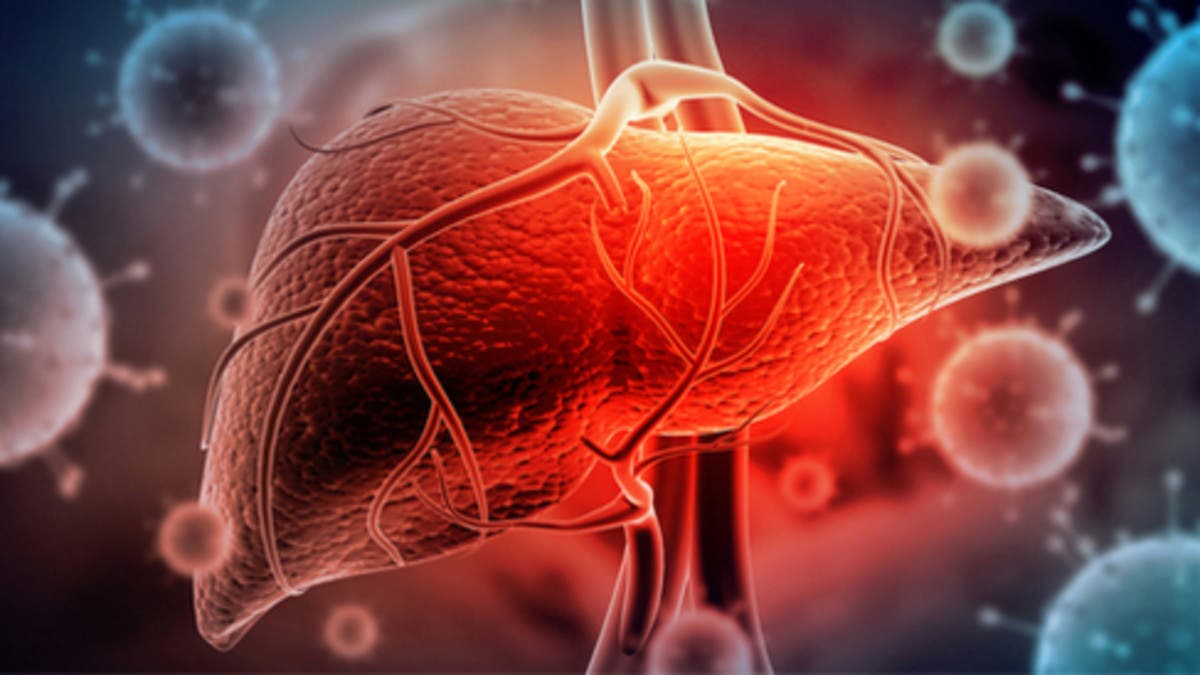 الصحة العالمية: هذه أعراض الالتهاب الكبدي الغامض المكتشفة