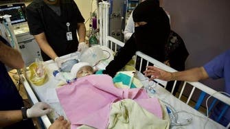 الفريق الجراحي لفصل التوأم اليمني الملتصق بالرأس يعلن وفاة أحدهما