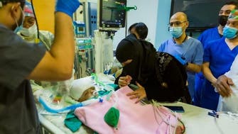 نجاح فصل التوأم السيامي اليمني "يوسف وياسين" في عملية استغرقت 15 ساعة