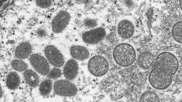 An electron microscopic (EM) image shows mature, oval-shaped monkeypox virus particles as well as crescents and spherical particles of immature virions, obtained from a clinical human skin sample associated with the 2003 prairie dog outbreak in this undated image obtained by Reuters on May 18, 2022. (File photo: Reuters)