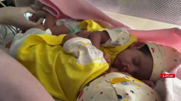 نقل التوأم السيامي اليمني مودة ورحمة من مطار عدن إلى الرياض (أرشيفية)