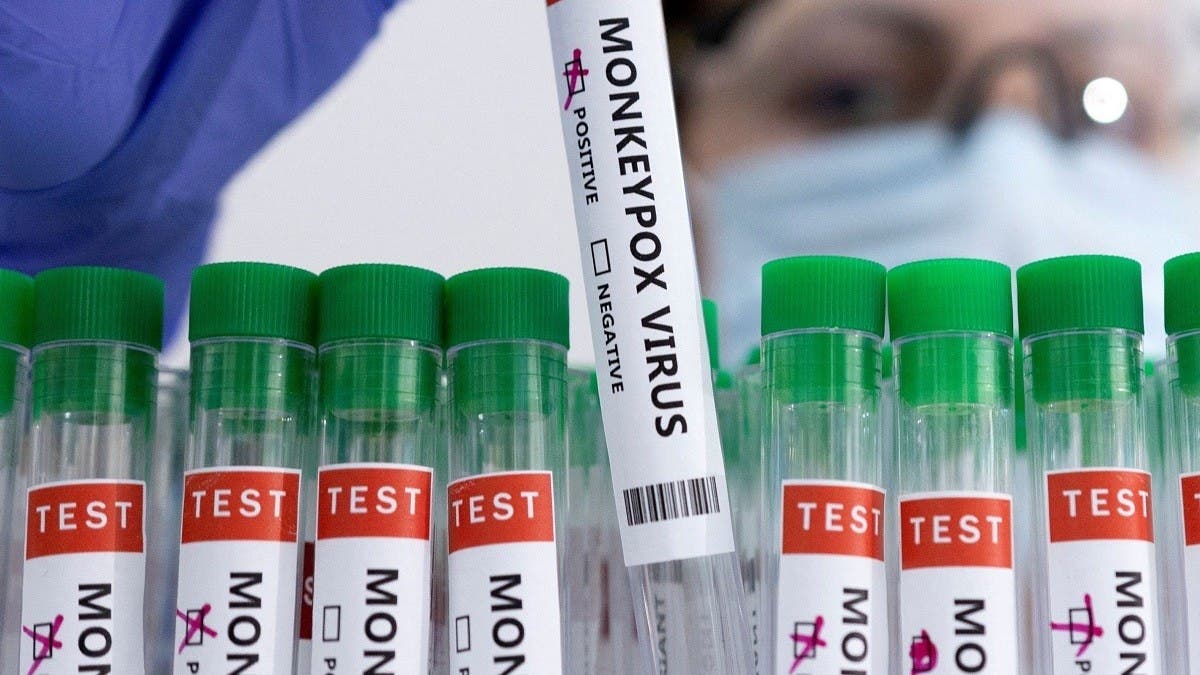 Smallpox vaccine offers 85 pct protection against monkeypox virus: UAE experts | Al Arabiya English