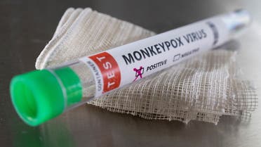 Test tube labelled Monkeypox virus positive are seen in this illustration taken May 22, 2022. (Reuters)