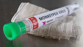 Russia reports first case of monkeypox                            