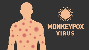 Monkeypox virus. Monkeypox virus banner design. Scars on the body. Vector design. stock illustration