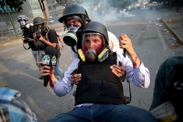 صحافي مصاب خلال مظاهرة مناهضة للرئيس الفنزويلي نيكولاس مادورو في كاراكاس عام 2019