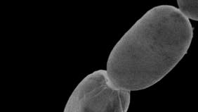 بالصور.. شاهد أكبر بكتيريا بالعالم ترى بالعين المجردة