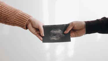 A couple holding an ultrasound image of a baby. (Unsplash, Jonathan Sanchez)