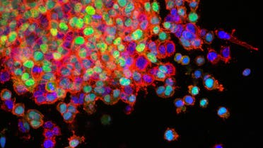 A stock image of cancer cells. (Unsplash, National Cancer Institute)