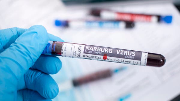 There is no cure for this.. Know the symptoms of “Marburg” virus and ways to prevent it