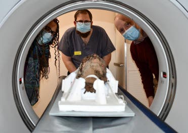 The mummy head undergoing a CT scan at Maidstone Hospital. (Supplied)