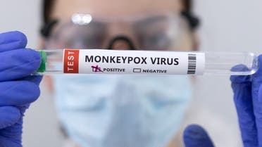 Test tubes labelled Monkeypox virus positive are seen in this illustration taken May 23, 2022. (Reuters)