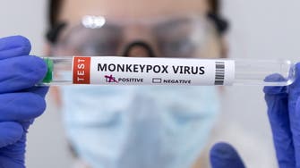 Spain reports second monkeypox death                          