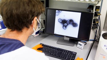 An employee of the vaccine company Bavarian Nordic shows a picture of a vaccine virus on a display in a laboratory of the company in Martinsried near Munich, Germany, May 24, 2022. (Reuters) 