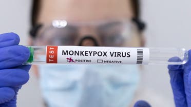 Test tubes labelled Monkeypox virus positive are seen in this illustration taken May 23, 2022. (Reuters)