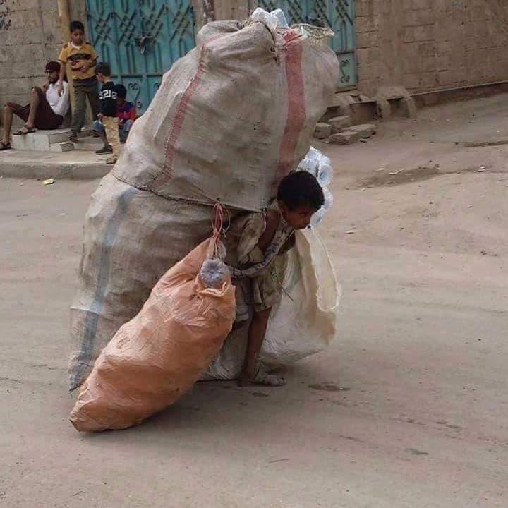 يحلمون بخيمة وقطعة خبز وكتاب.. أطفال اليمن: الوجه القبيح للإنسانية