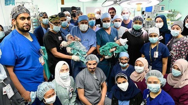 Team of 28 Saudi doctors successfully separate Yemeni cojoined twins