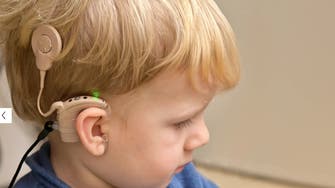 علاج جيني جديد قد يمنع فقدان السمع الوراثي