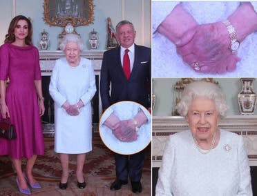 Ее черты были расслаблены, когда она приветствовала иорданского короля и его жену, а пятно было на левой руке.