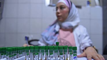 A lab technician works on samples to test for cholera, at a hospital in Syria's northern city of Aleppo on September 11, 2022. Cholera is generally contracted from contaminated food or water, and causes diarrhoea and vomiting. It can spread in residential areas that lack proper sewage networks or mains drinking water. (AFP)