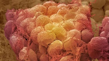 خلايا دهنية تم تلوينها لإظهار الخلايا العصبية المحيطة بها