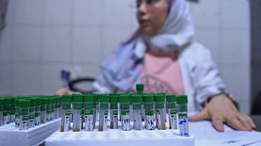 A lab technician works on samples to test for cholera, at a hospital in Syria's northern city of Aleppo on September 11, 2022. Cholera is generally contracted from contaminated food or water, and causes diarrhoea and vomiting. It can spread in residential areas that lack proper sewage networks or mains drinking water. (Photo by AFP)