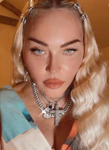 مادونا بعد خضوعها لعمليات تجميلية في وجهها