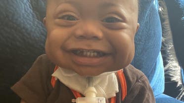 DJ Edmonds, a premature baby who had to be ventilated and resuscitated twice shortly after birth due to heart failure, is now developing well thanks to a rare surgery pioneered by Hani Najm, MD, a Saudi pediatric and congenital heart surgeon practicing at Cleveland Clinic Children’s in the US. (Supplied)