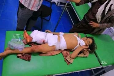 جريمة حوثية جديدة في تعز.. بتر رجلي طفلين بسبب قذيفة 5 أحد الأطفال المصابين