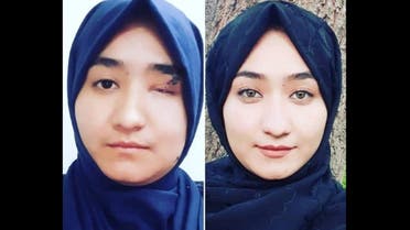 Afghan teenager Fatemeh Amiri, 17, who was seriously injured in a suicide attack on her school in Kabul on September 30, 2022. (Twitter)