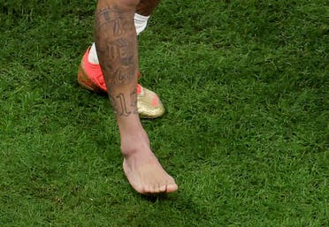 Neymar's foot is clearly swollen