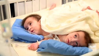 Doctors in Saudi Arabia begin operation to separate Iraqi conjoined twins