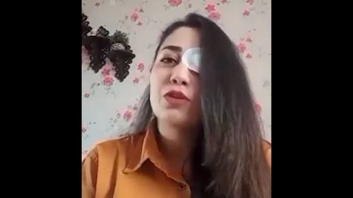 Iran’s security forces targeting eyes of protesters: Rights group