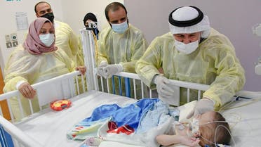 Twins Omar and Ali underwent an 11-hour-surgery on January 12 at the King Abdullah Specialized Children’s Hospital in Riyadh. (SPA)